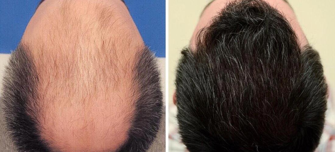 مورویان در تهران؛ تصویر 1 از فضای مجموعه و نمونه‌کارها