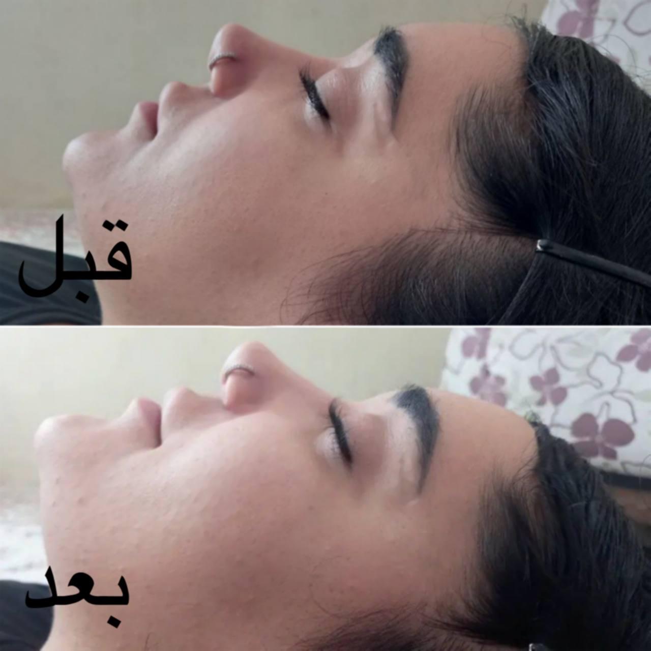 تصویر 2 آگهی فیشال تخصص 