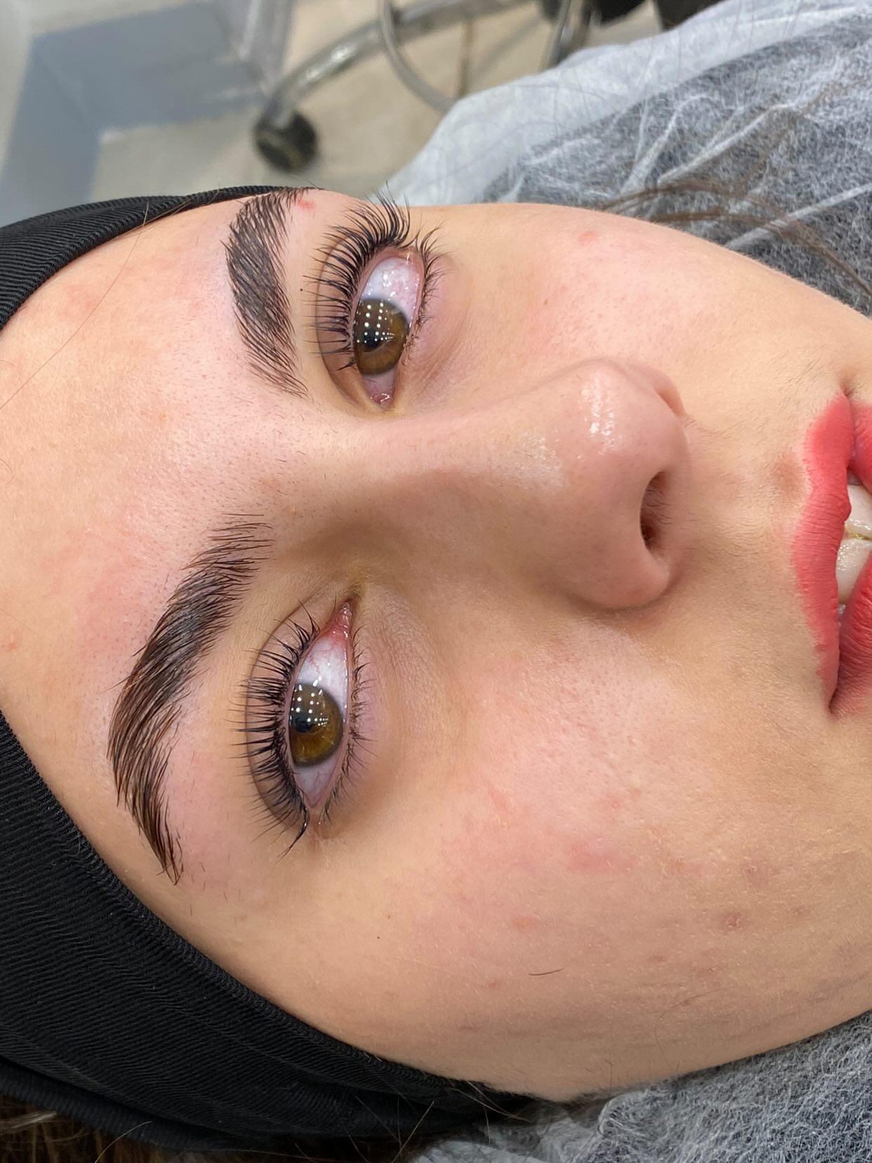 تصویر 3 آگهی لیفت،لمینت،بوتاکس و احیای مژه و ابرو با ٪۱۵تخفیف  