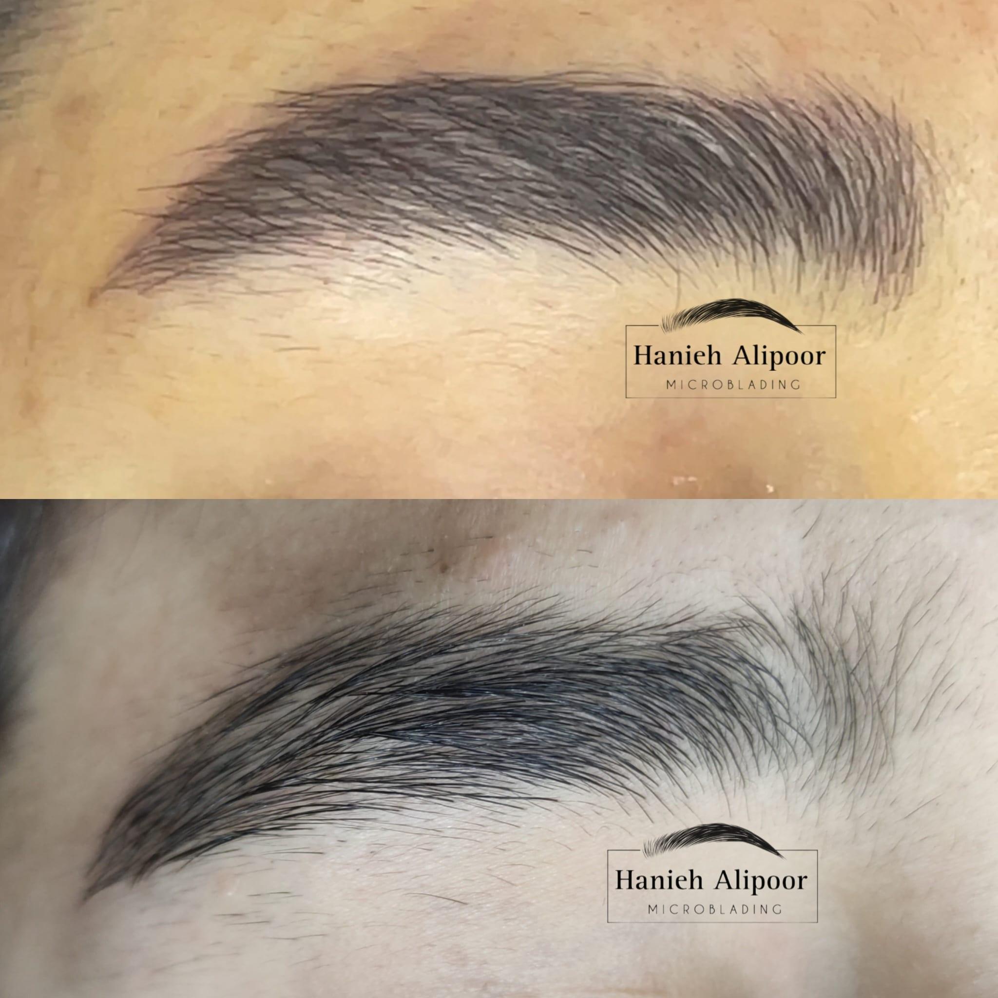 میکروبلیدینگ تخصصی ابرو