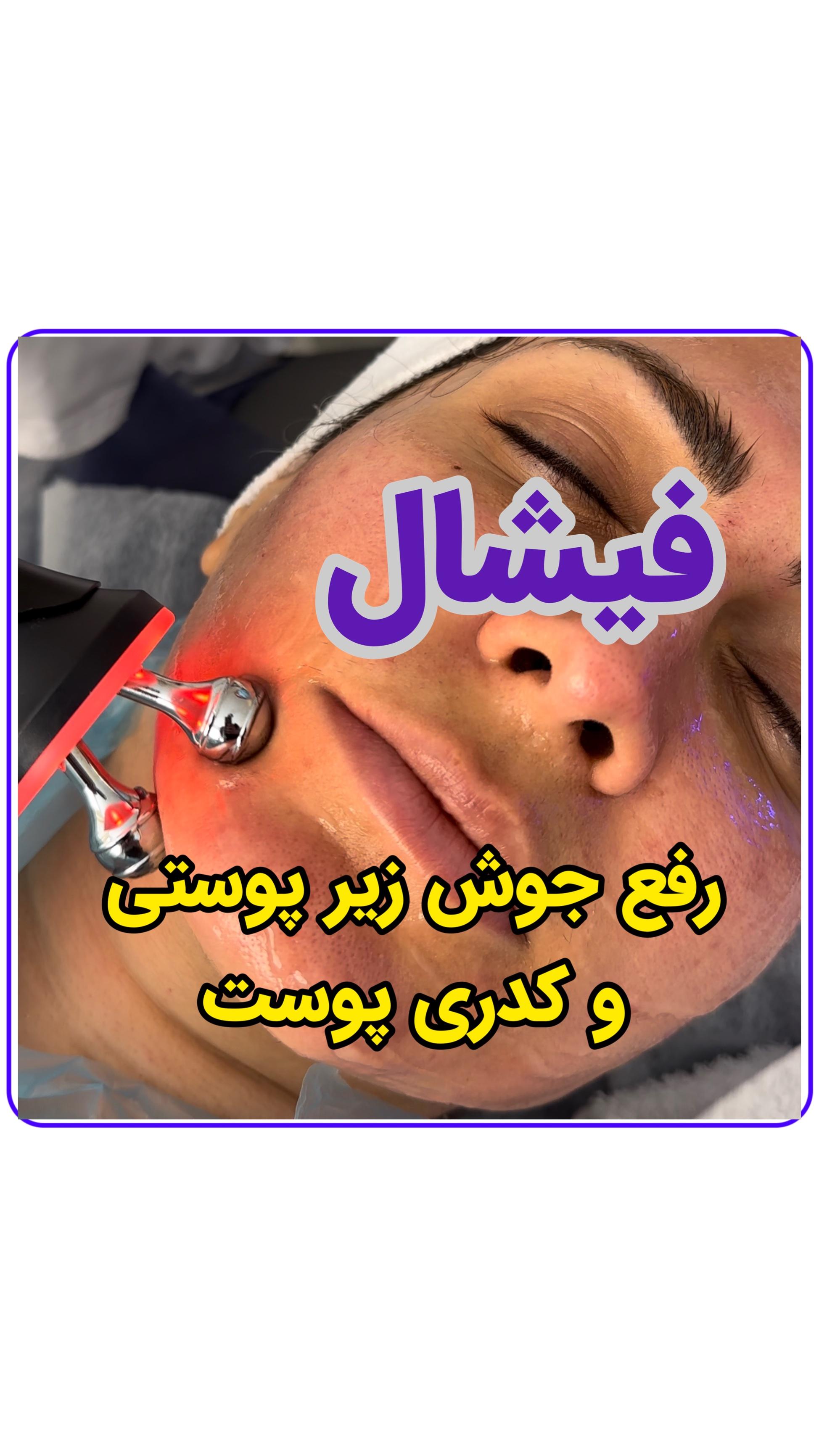 اسکین تراپیست 