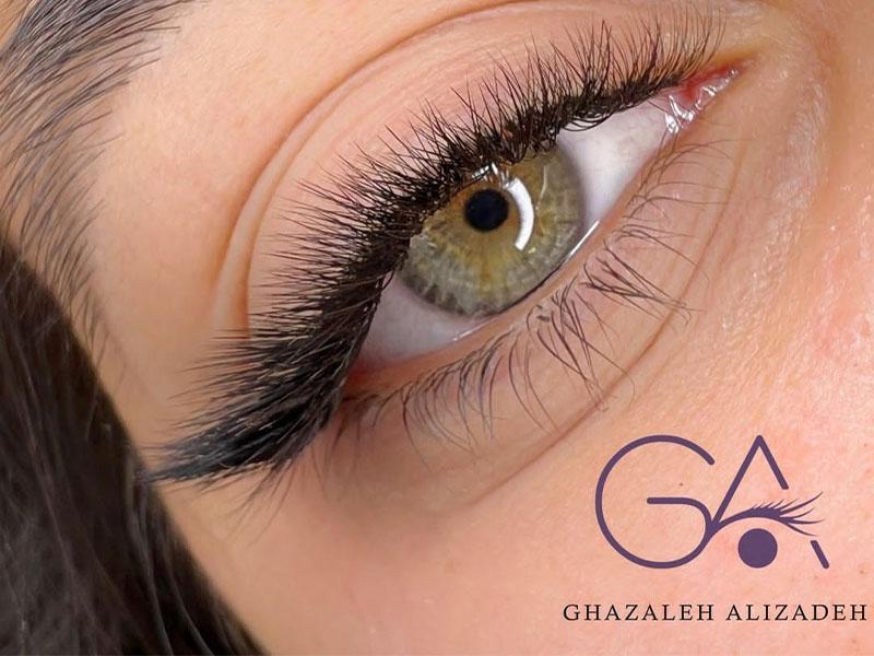 خدمات غزاله علیزاده