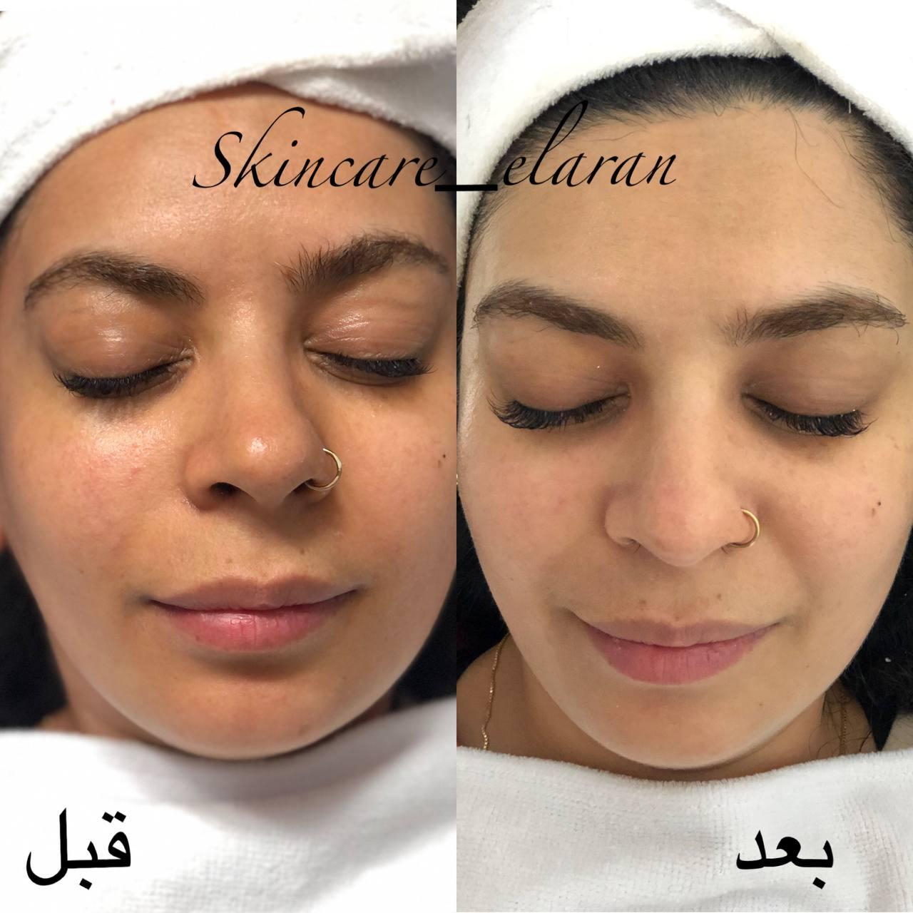 فیشال تخصص