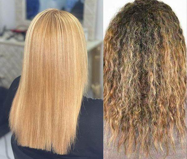 معرفی آرژنین تراپی